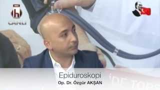 Epiduroskopi - Op. Dr. Özgür AKŞAN