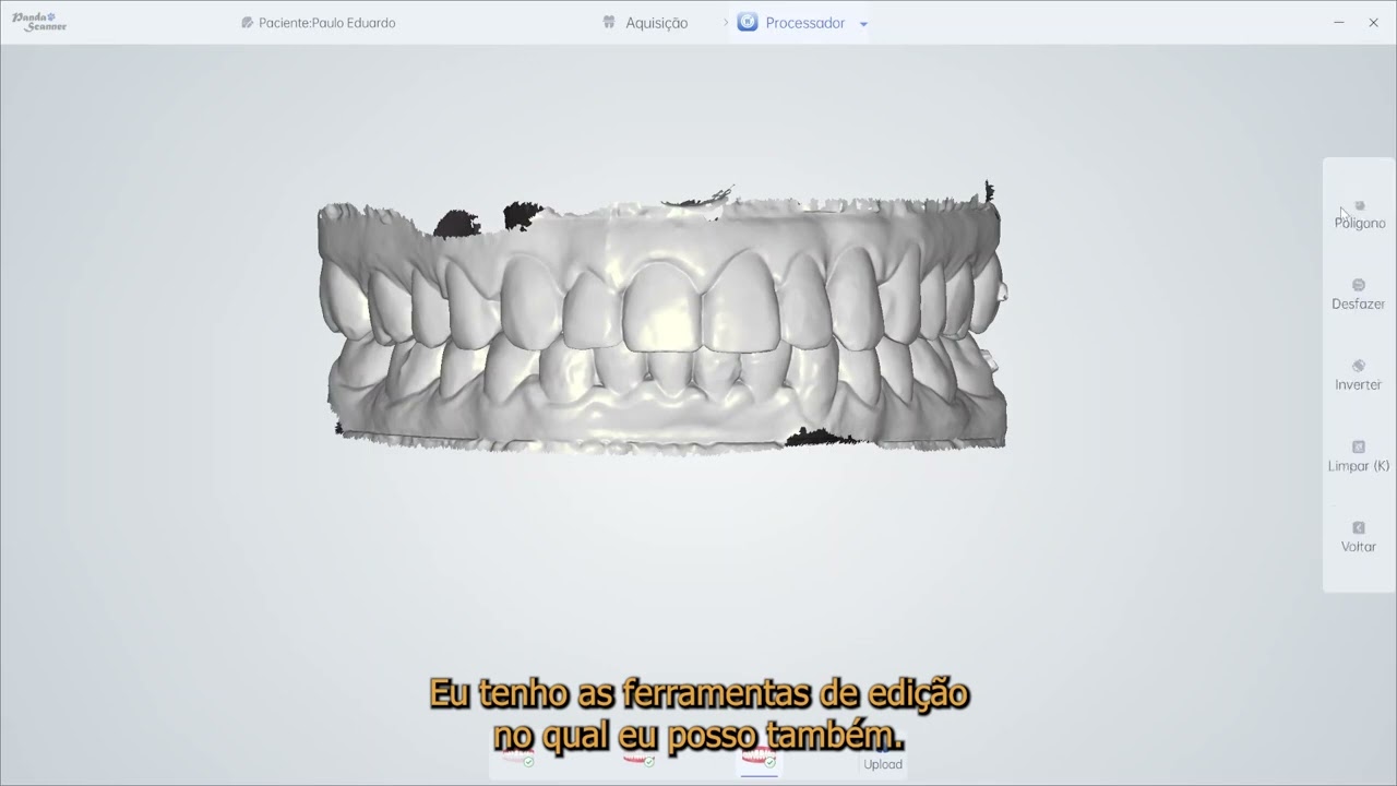 Vídeo 25 - Ferramentas adicionais do modo ortodontia