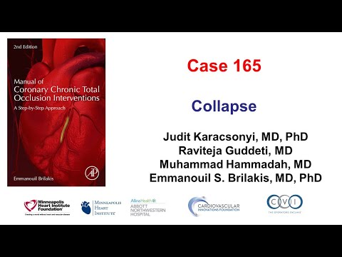 Case 165: Manual of CTO PCI - Collapse