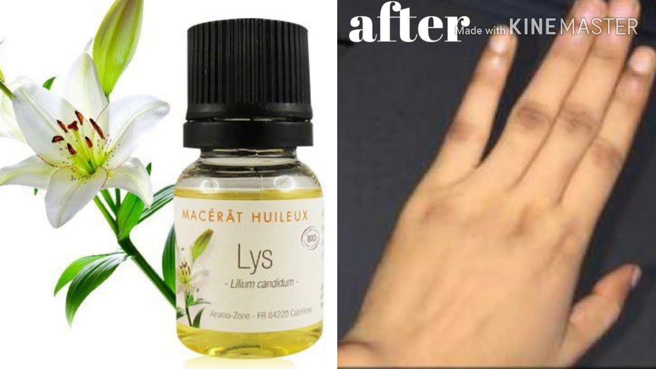 LES HUILES ESSENTIELLES CONTRE L' HYPERPIGMENTATION|KAFUI CHAÎNE OFFICIELLE