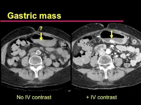 Looking inside for a diagnosis | UCSF Radiology