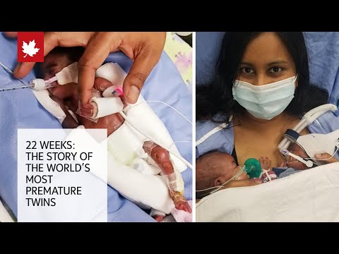 22 Weeks: The story of the world's most premature twins