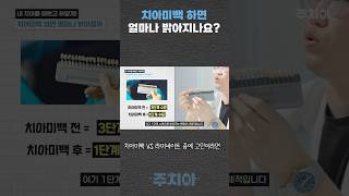 치아 미백 성형 시술