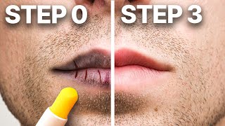 How To Treat Chapped Lips in 3 Easy Steps (Dermatologist)