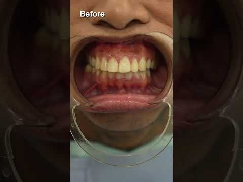 Whamos' worth 1M smile! 🧡💚