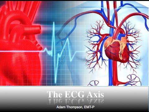ECG Axis Tutorial: Part 3 - Determining QRS Axis
