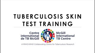 TUBERCULOSIS SKIN TEST TRAINING