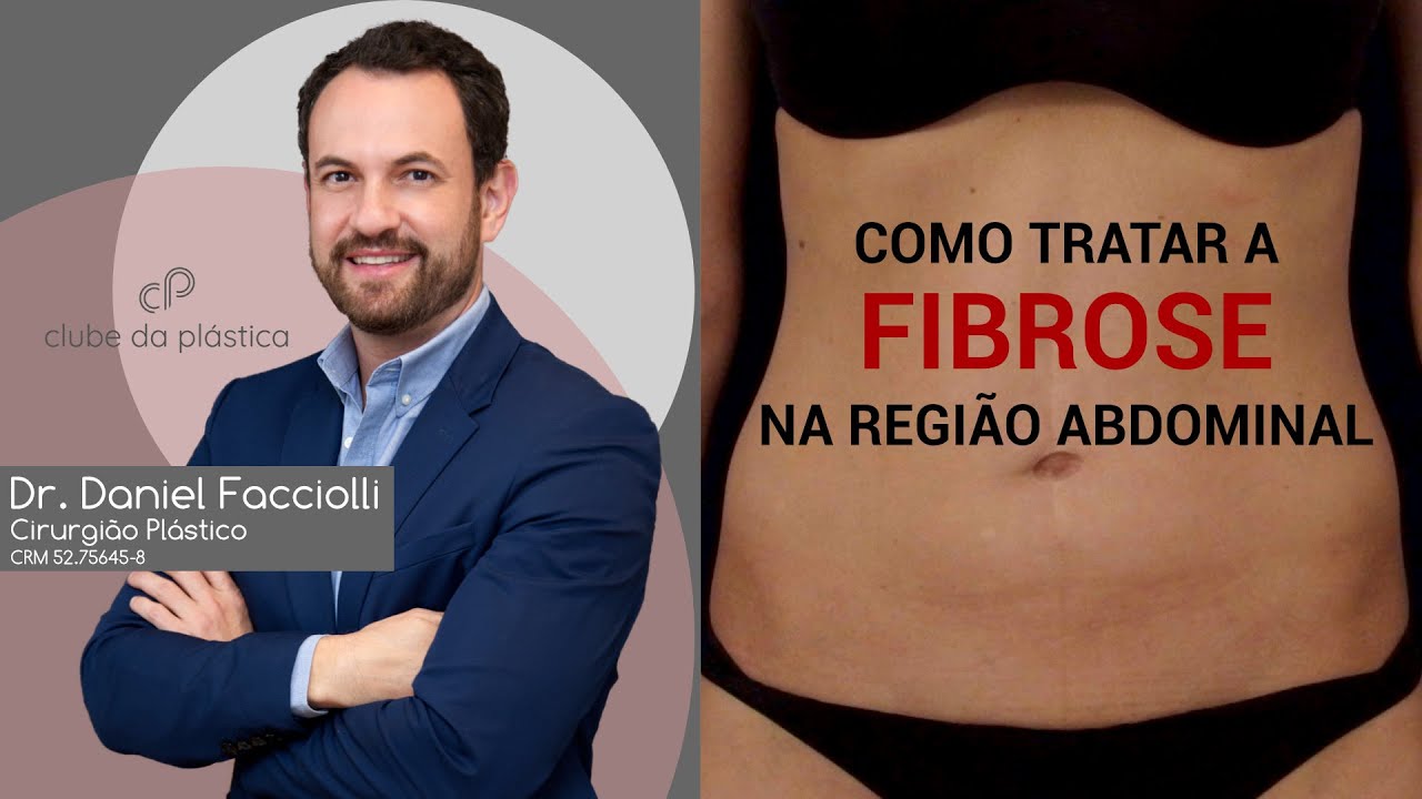Clube da Plástica: Como tratar a fibrose na região abdominal