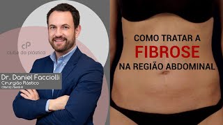 Clube da Plástica: Como tratar a fibrose na região abdominal