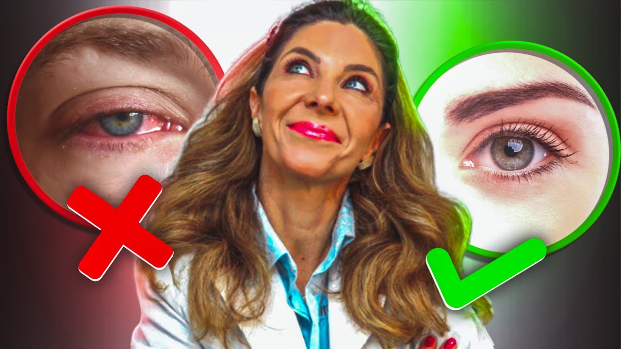 Conjuntivite - Tratamento Caseiro Para Aliviar Conjuntivite