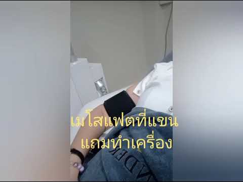 เมโสแฟต ยี่ห้อไหนดี
