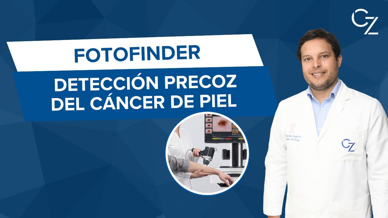 Gonzalo Ziegler Rodriguez-12