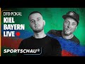 View 25 Dfb Pokal Live Bayern