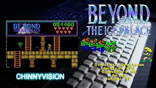 Download Lagu ChinnyVision - Ep 485 - Beyond The Ice Palace - C64, Amstrad CPC, Spectrum, Atari ST, Amiga Thumbnail