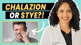 Red bump on your eye? Stye vs Chalazion with Dr. Sherene Vazhappilly, O.D.