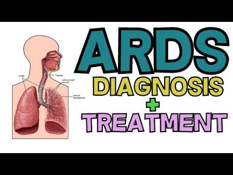 DIAGNOSIS AND TREATMENT OF ACUTE RESPIRATORY DISTRESS SYNDROME (ARDS)