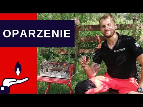 How to Treat Burns? First Aid in One Minute