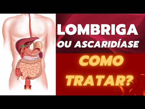Dicas de Saúde Dr Marcelo Sandrín: Lombriga ou Ascaridíase, como tratar?