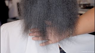 Hormone Tests For Hair Loss.
