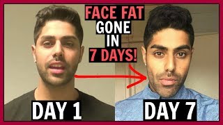 How To Reduce FACE FAT In 1 Week - 100% WORKS!!