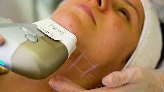 Ultraformer na Papada - Aula Completa