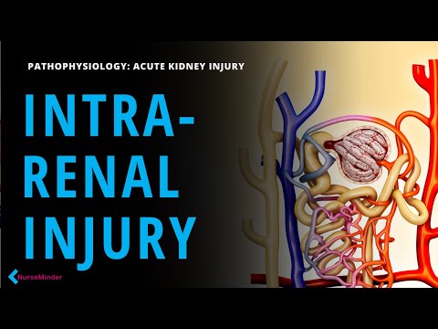 Intrarenal Kidney Injury: Why Nurses MUST Evaluate Urine Status
