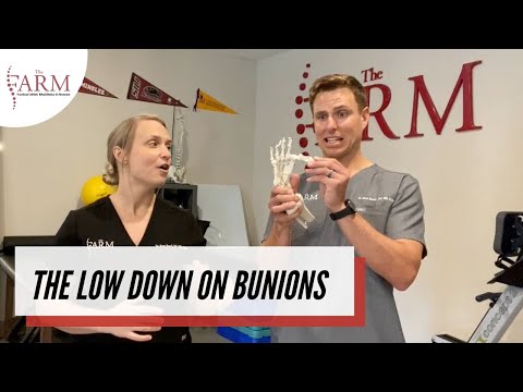Bunions Defined, Treatment Options, Rehab Drills and Performance Tips