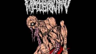 Tortured Maternity - Dissecting The Murderous Flesh