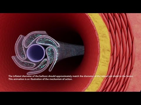 IN.PACT™ Admiral™ and IN.PACT™ 018 drug-coated balloons (DCB) Mechanism of Action