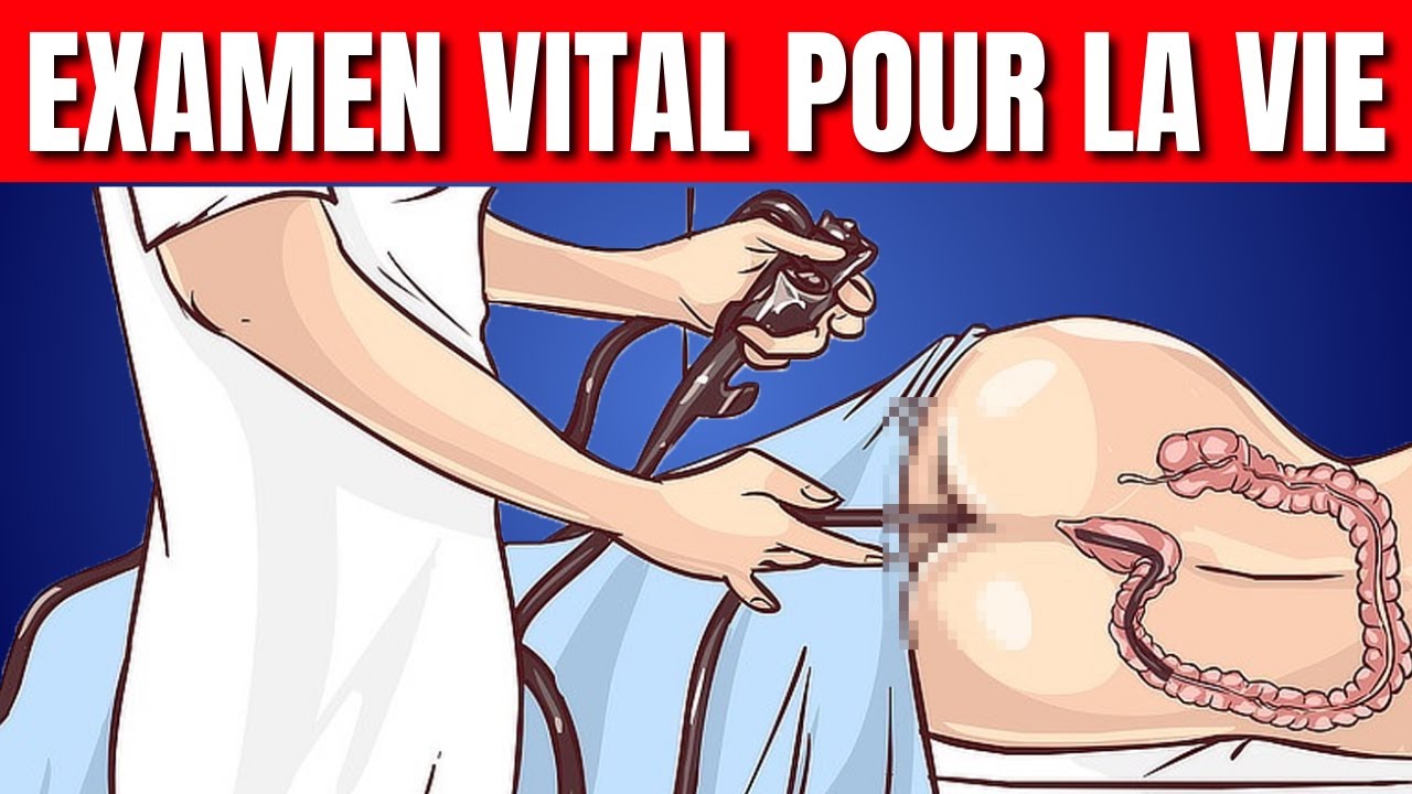 Ce Qu’on Ne Vous a Jamais Dit sur la Coloscopie 🧐 Évitez les Mauvaises Surprises !