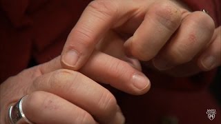 Mayo Clinic Minute: Winter skin protection ideas