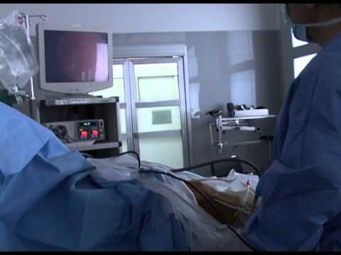 Radioulnare distale asse comune Dolore addominale in osteocondrosi seno