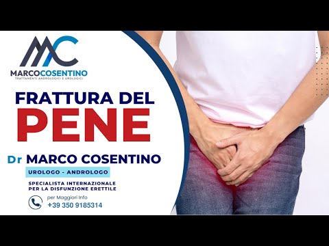 Marco Cosentino-10