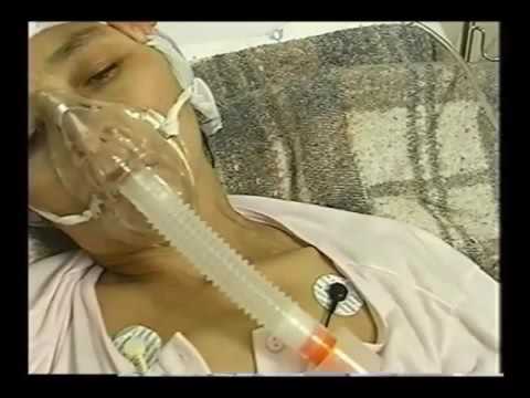 Propedêutica de Enfermagem 05   Exame do Tórax e Aparelho Respiratório   PARTE 1360p H 264 AAC