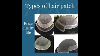 Types of hair patches