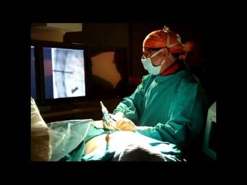 Articolazioni breve anatomia Necrosi asettica del ginocchio