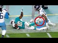 Tyreek Hill Injured After Dangerous Tackle Doctor Explains