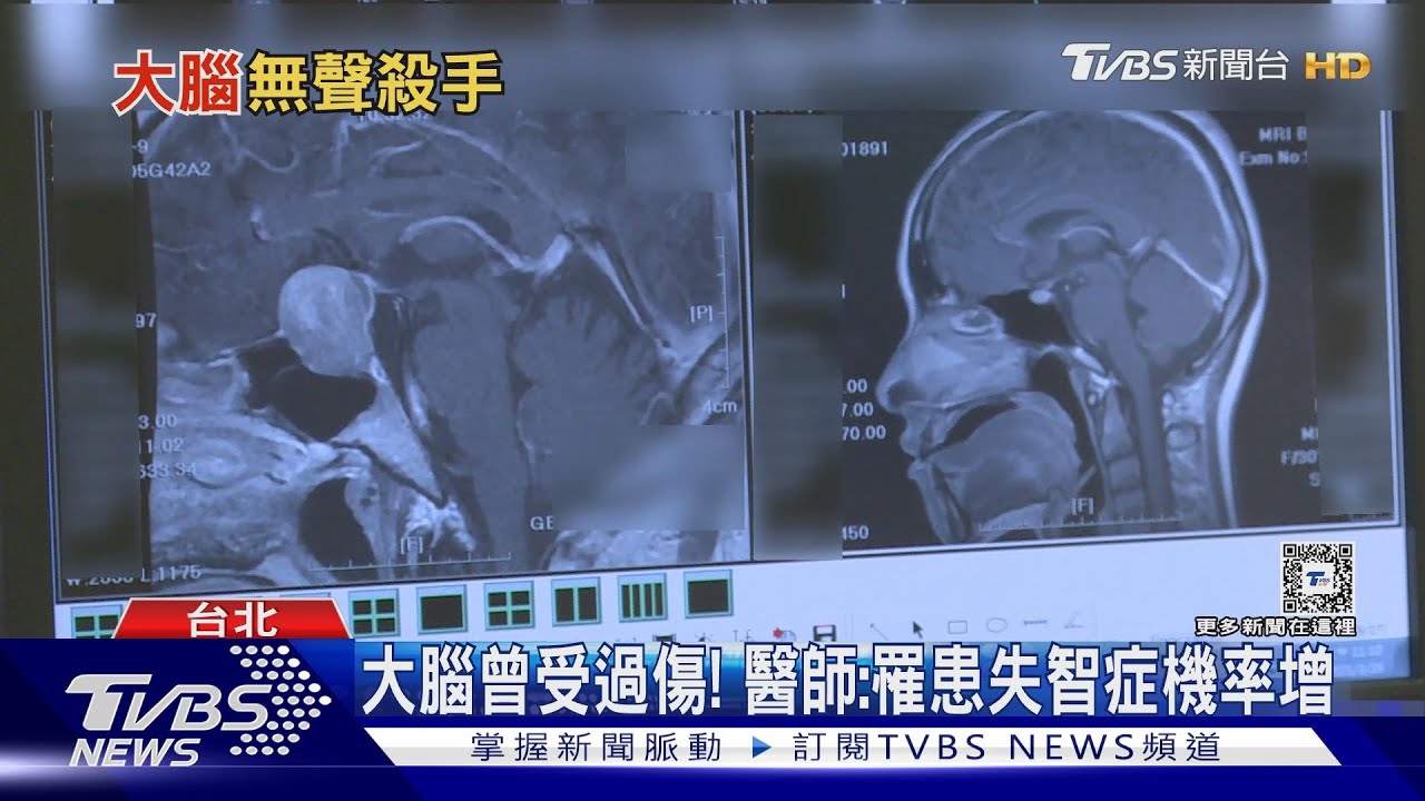三高失控！易導致「這疾病」發生　醫師警告：提高警覺