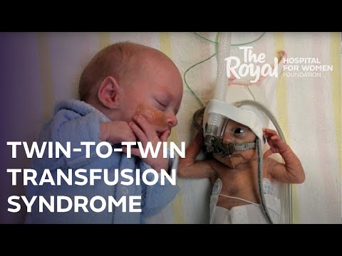 Twin-To-Twin Transfusion Syndrome (TTTS): Nicole's Story