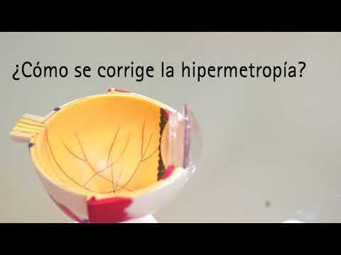 Cum sunt tratate hipermetropia