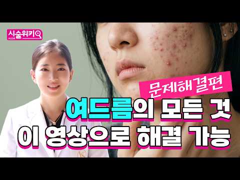여드름에도 종류가 있다고?