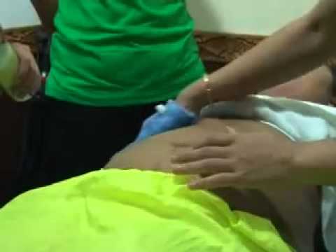 Barley mash dengan penurunan berat badan Saya ingin menurunkan berat badan dan untuk menghilangkan lemak perut