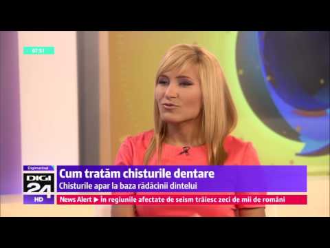 Cum tratam chisturile dentare