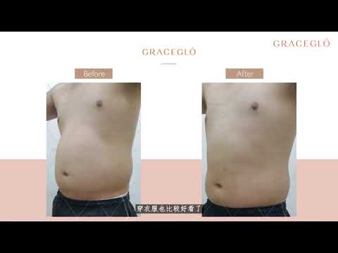 “躺着就会瘦”系列 -- 只需5个星期，腰围减少10公分！无需节食，不会反弹！