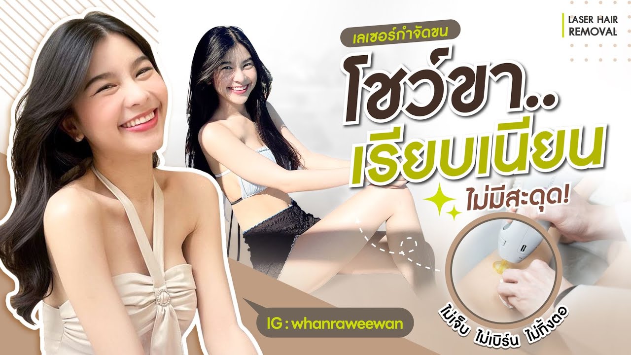 รีวิวเลเซอร์ขนขา YAG 1064 ผิวเรียบเนียนไม่แสบเบิร์น