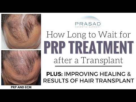 Safe Timing of PRP Scalp Injections After a Hair...