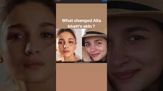 Download lagu Alia Bhatt skin transformation! #aliabhatt #bollywood #aliabhat #sunscreen #celebrityskincare mp3