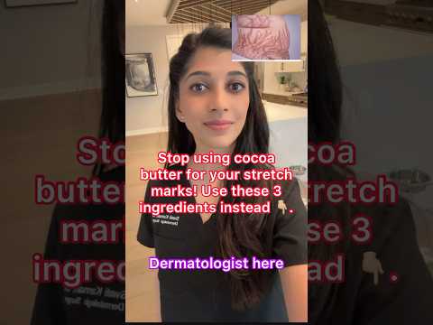 Stop Using Cocoa Butter for Stretch Marks. Use THIS Instead