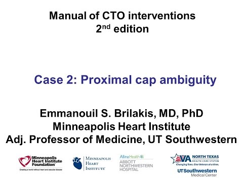 Case 2: Manual of CTO Interventions - Scratch and go for proximal cap ambiguity