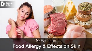 Food Allergy & how it affects SKIN | Causes, Symptoms & Treatment-Dr.Rajdeep Mysore |Doctors